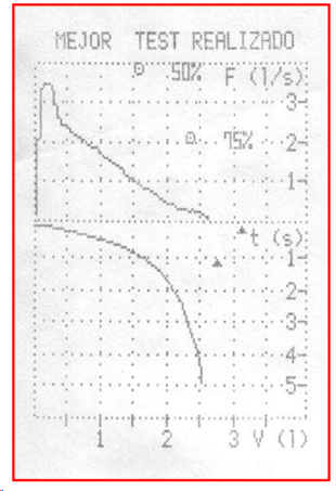 ESPIROMETRIA PRE- BRONCODILATACIÓN